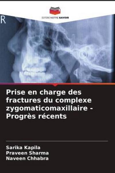 Prise en charge des fractures du complexe zygomaticomaxillaire - Progrès récents