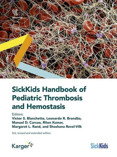 SickKids Handbook of Pediatric Thrombosis and Hemostasis 