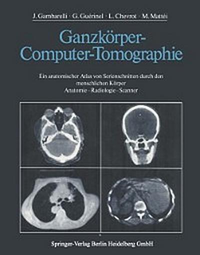 Ganzkörper-Computer-Tomographie