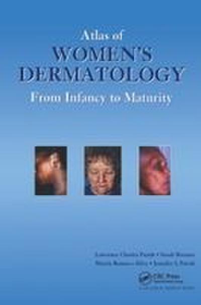 Atlas of Women’s Dermatology