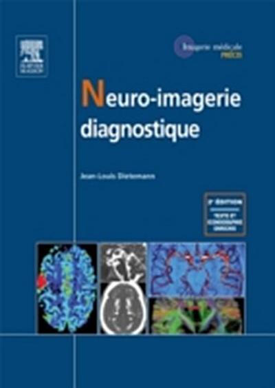 Neuro-imagerie diagnostique