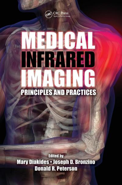 Medical Infrared Imaging