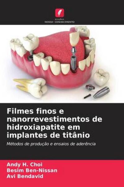 Filmes finos e nanorrevestimentos de hidroxiapatite em implantes de titânio