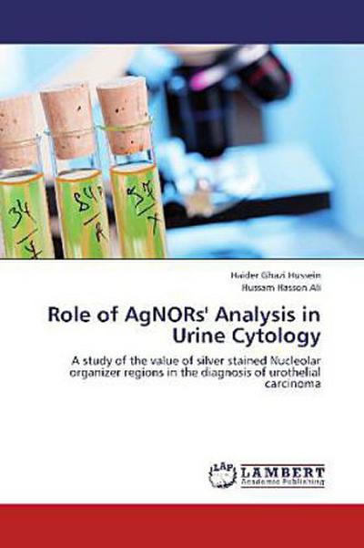 Role of AgNORs’ Analysis in Urine Cytology