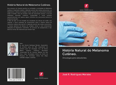 História Natural do Melanoma Cutâneo.