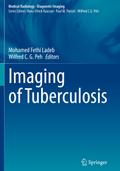 Imaging of Tuberculosis