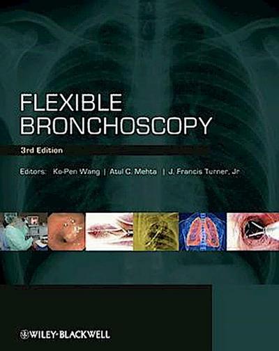 Flexible Bronchoscopy