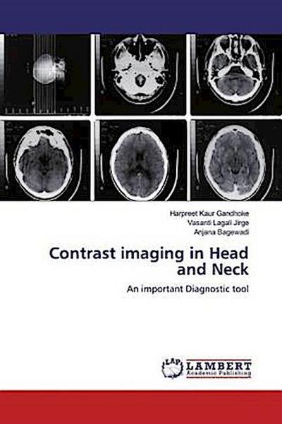 Contrast imaging in Head and Neck