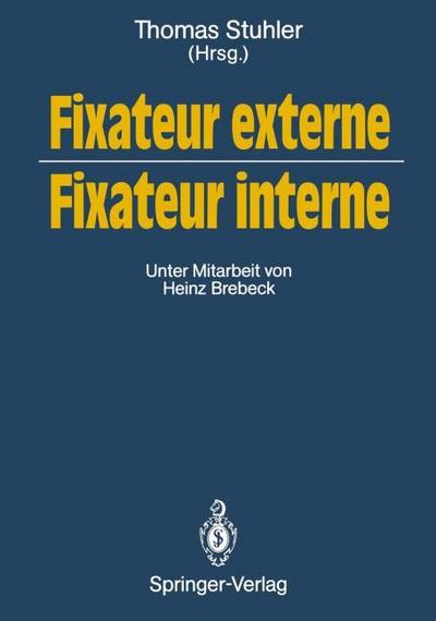 Fixateur externe ¿ Fixateur interne