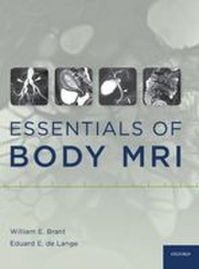 Essentials of Body MRI