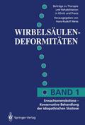 Erwachsenenskoliose