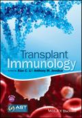 Transplant Immunology