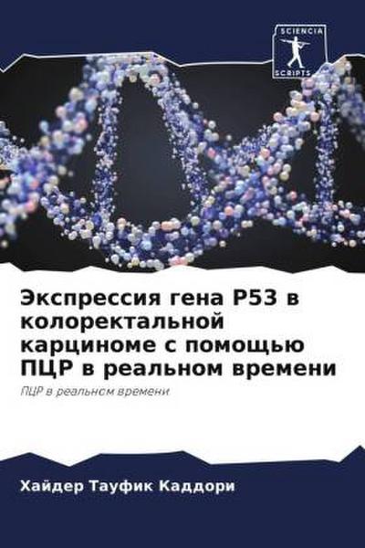 Jexpressiq gena P53 w kolorektal’noj karcinome s pomosch’ü PCR w real’nom wremeni