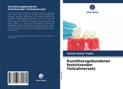 Kunstharzgebundener festsitzender Teilzahnersatz