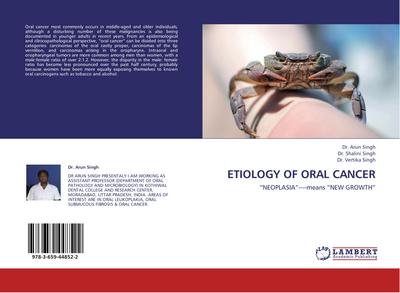 Etiology of Oral Cancer