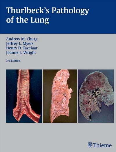 Thurlbeck’s Pathology of the Lung