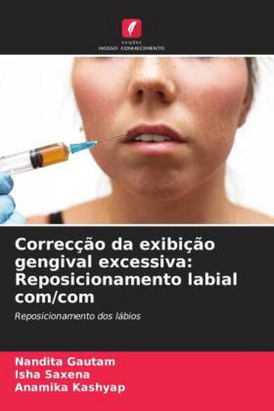Correcção da exibição gengival excessiva: Reposicionamento labial com/com