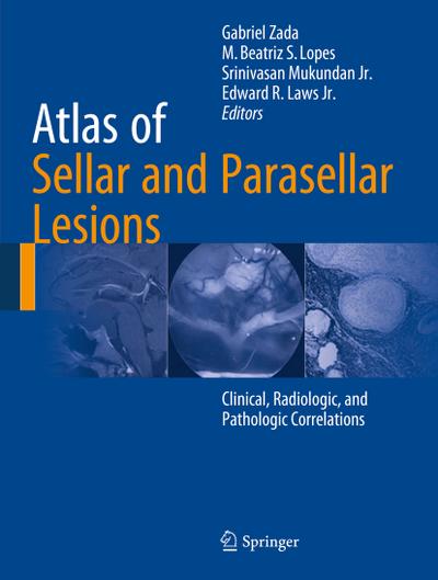 Atlas of Sellar and Parasellar Lesions