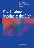 Post-treatment Imaging of the Orbit