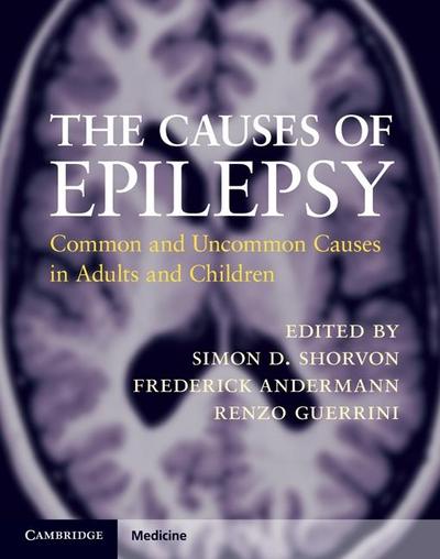 Causes of Epilepsy