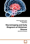 Neuroimaging and Early Diagnosis of Alzheimer Disease