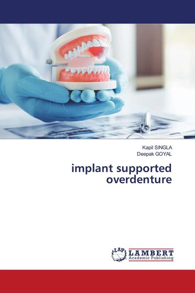 implant supported overdenture