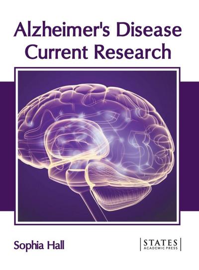Alzheimer’s Disease: Current Research