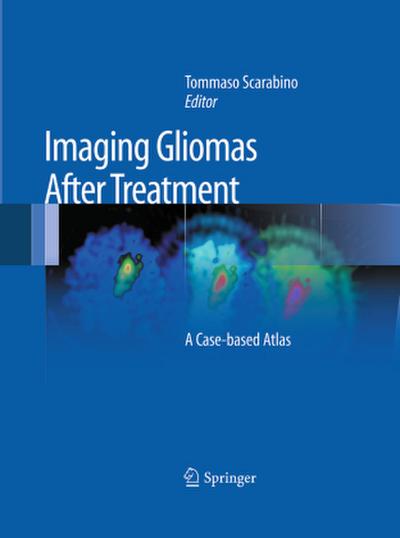 Imaging Gliomas After Treatment