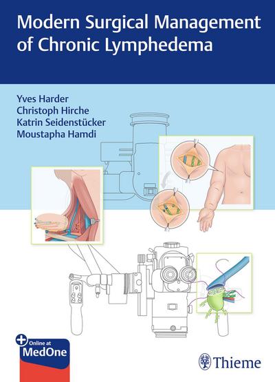Modern Surgical Management of Chronic Lymphedema