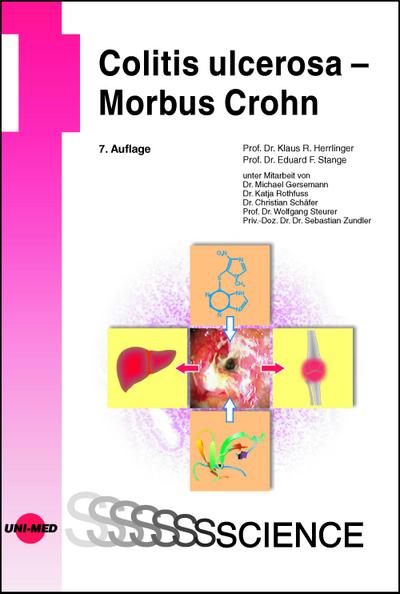 Colitis ulcerosa - Morbus Crohn