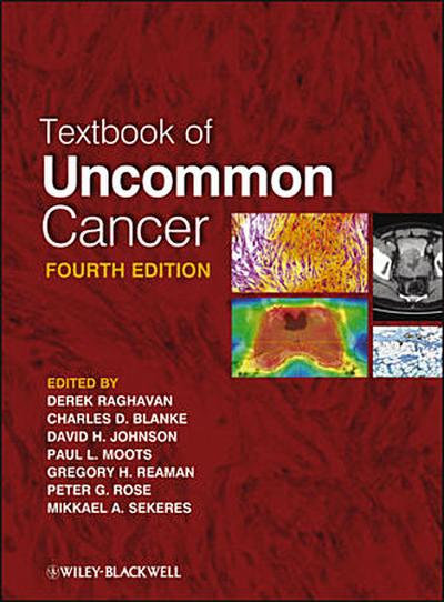 Textbook of Uncommon Cancer