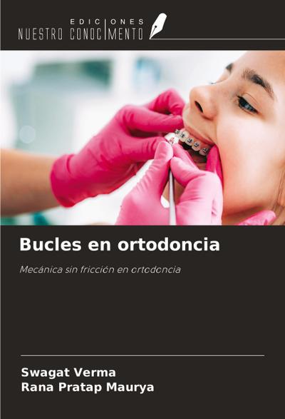 Bucles en ortodoncia