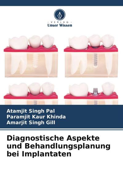 Diagnostische Aspekte und Behandlungsplanung bei Implantaten