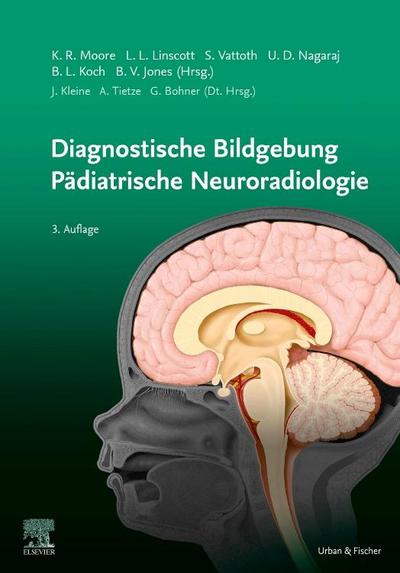 Diagnostische Bildgebung Pädiatrische Neuroradiologie