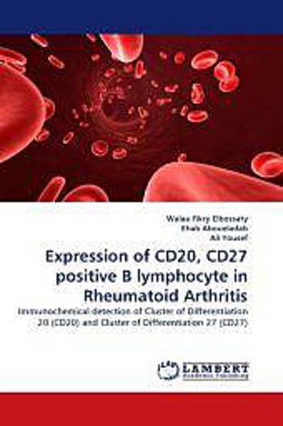 Expression of CD20, CD27 positive B lymphocyte in Rheumatoid Arthritis
