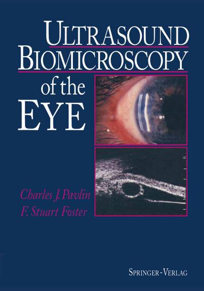 Ultrasound Biomicroscopy of the Eye