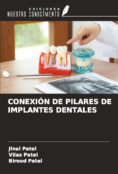 CONEXIÓN DE PILARES DE IMPLANTES DENTALES