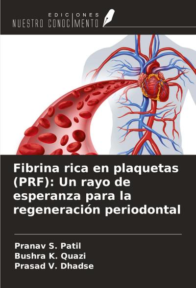 Fibrina rica en plaquetas (PRF): Un rayo de esperanza para la regeneración periodontal