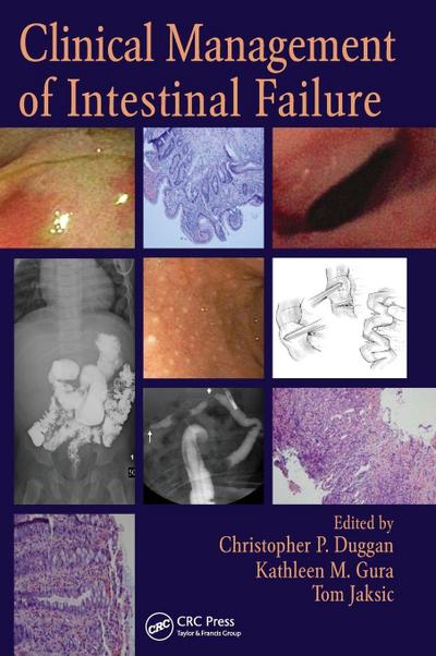 Clinical Management of Intestinal Failure
