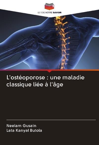 L’ostéoporose : une maladie classique liée à l’âge