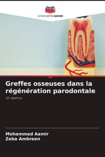Greffes osseuses dans la régénération parodontale
