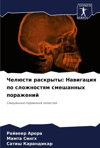 Chelüsti raskryty: Nawigaciq po slozhnostqm smeshannyh porazhenij