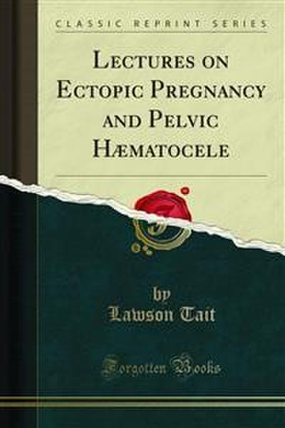 Lectures on Ectopic Pregnancy and Pelvic Hæmatocele