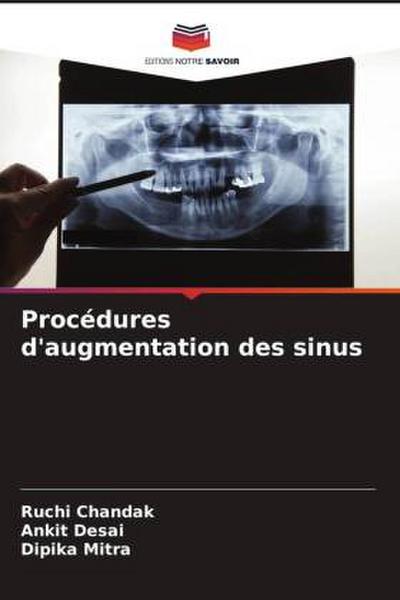 Procédures d’augmentation des sinus