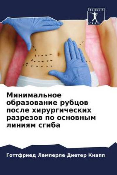 Minimal’noe obrazowanie rubcow posle hirurgicheskih razrezow po osnownym liniqm sgiba