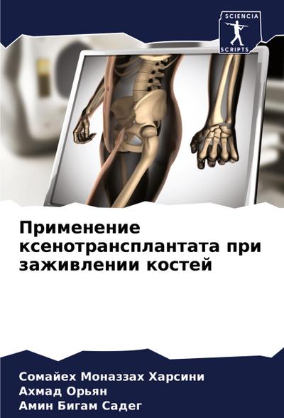 Primenenie xenotransplantata pri zazhiwlenii kostej