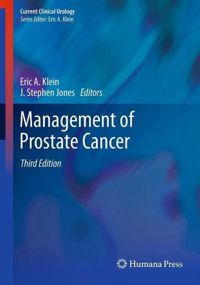 Management of Prostate Cancer