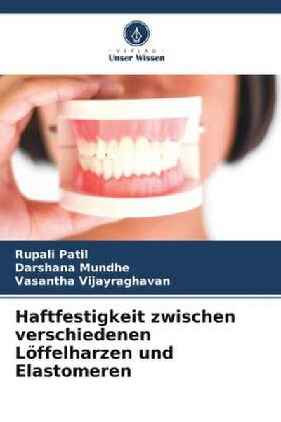 Haftfestigkeit zwischen verschiedenen Löffelharzen und Elastomeren