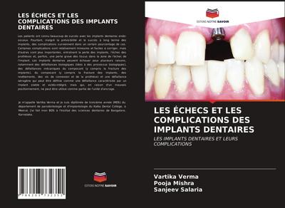 LES ÉCHECS ET LES COMPLICATIONS DES IMPLANTS DENTAIRES