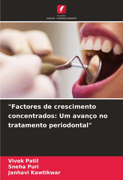"Factores de crescimento concentrados: Um avanço no tratamento periodontal"